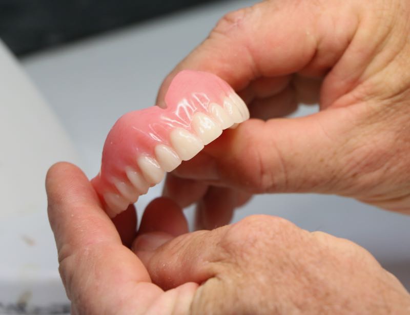 denture inspection